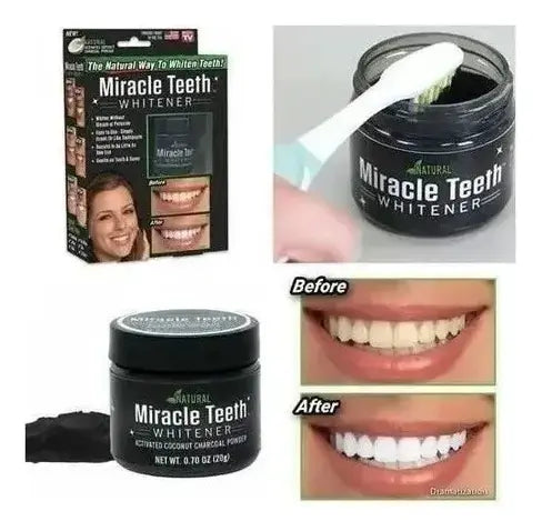 Blanqueador Dental De Carbon Activado Dientes Blancos
