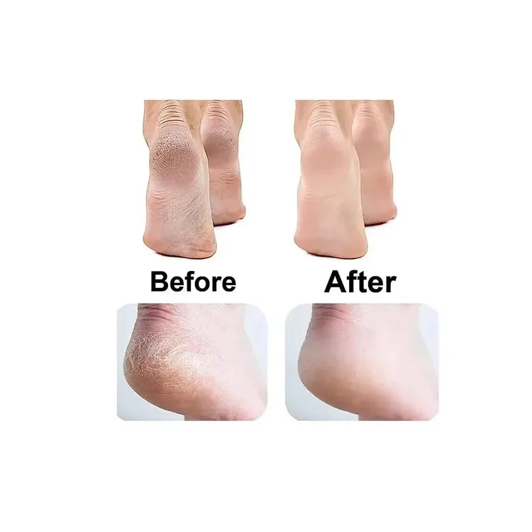 Quita Durezas Recargable Vertical Con Luz Led